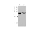 FSH beta Polyclonal Antibody