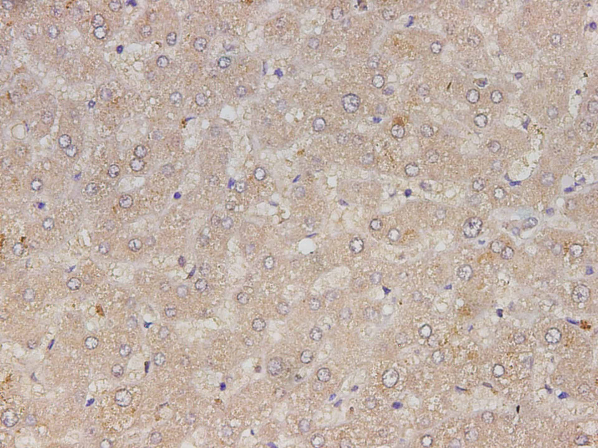 RETN Polyclonal Antibody Reactivity Human