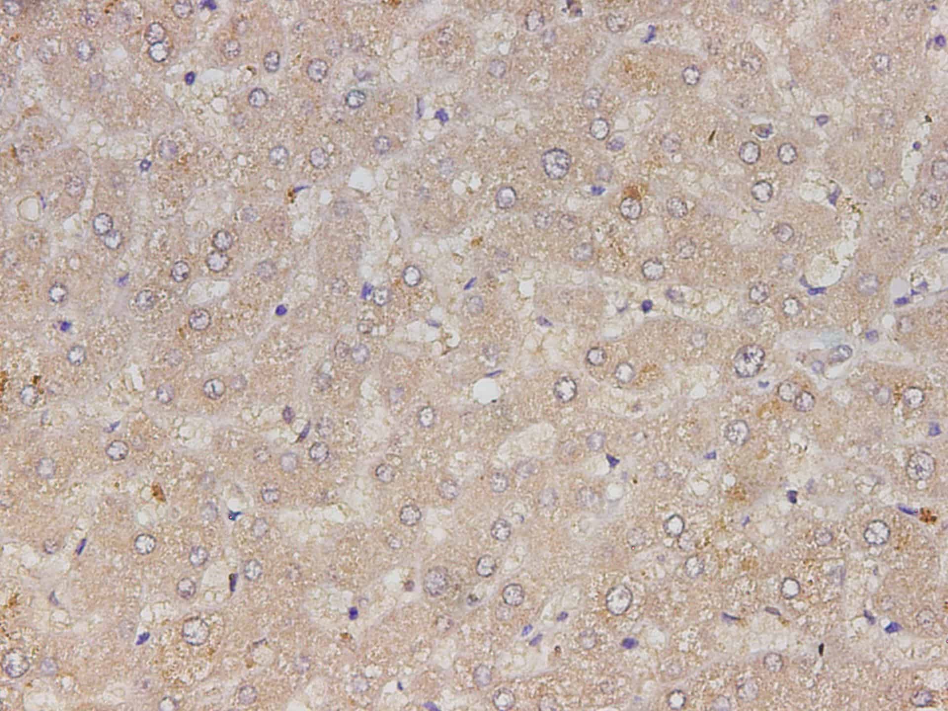 RETN Polyclonal Antibody Reactivity Human