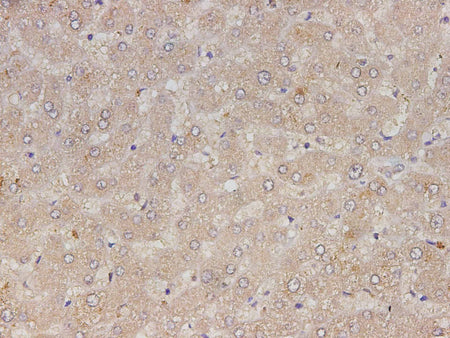 RETN Polyclonal Antibody Reactivity Human