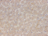 RETN Polyclonal Antibody Reactivity Human