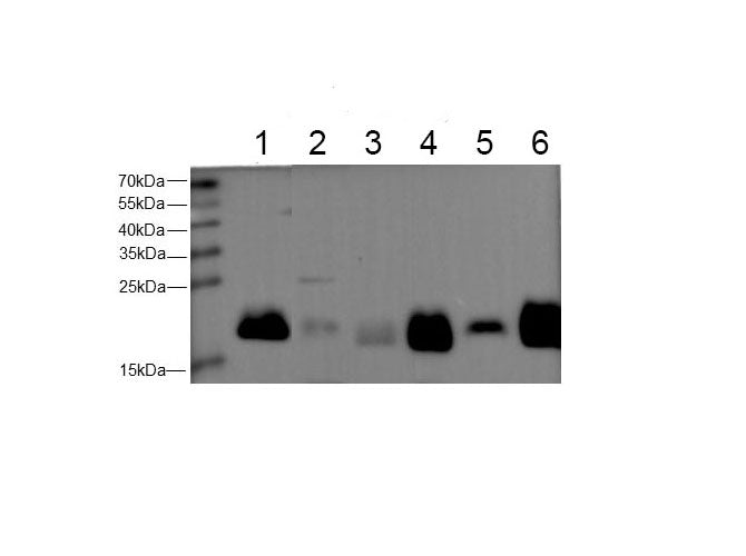 Ferritin Heavy Polyclonal Antibody