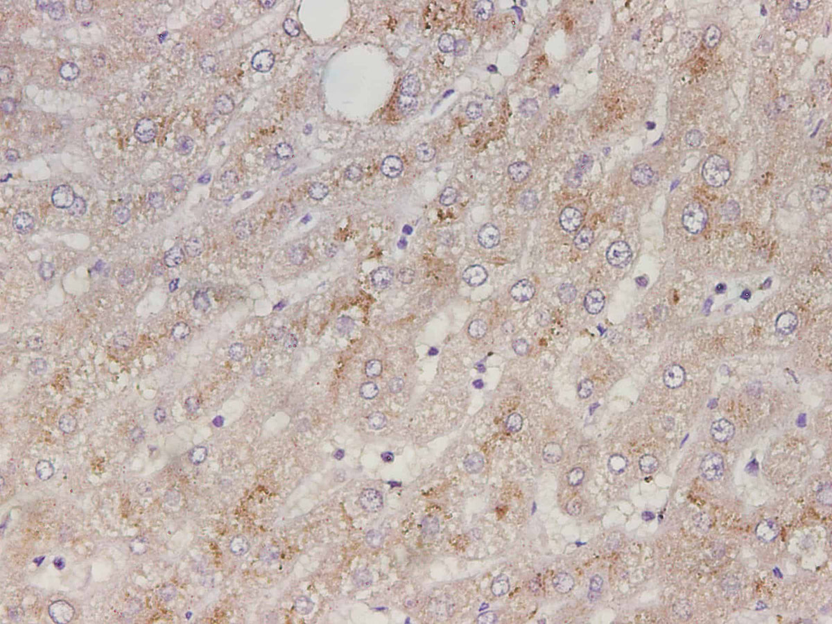 Serpin A1 Polyclonal Antibody