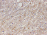 Serpin A1 Polyclonal Antibody