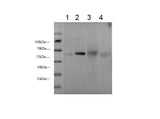 Serpin A1 Polyclonal Antibody