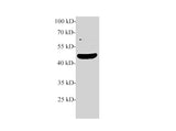 TGF beta 2 Polyclonal Antibody