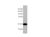 Lutropin subunit beta/LHB Polyclonal Antibody