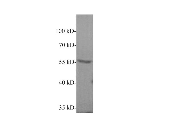 Carboxypeptidase B2 Polyclonal Antibody