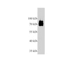 NF2 / Merlin Polyclonal Antibody