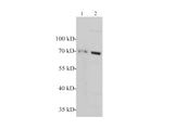NF2 / Merlin Polyclonal Antibody
