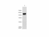 PAI1 Polyclonal Antibody