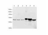 Lgals3 Polyclonal Antibody Reactivity Human