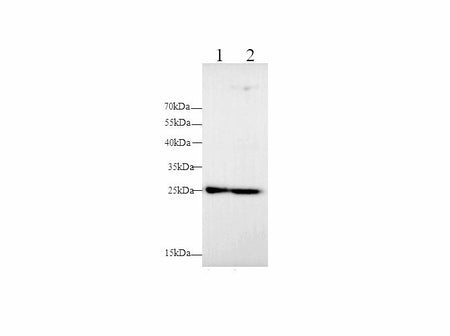 MMP-7 Polyclonal Antibody