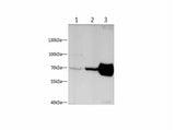 NEFL Polyclonal Antibody Reactivity Human