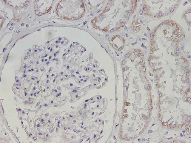 Maoa Polyclonal Antibody Reactivity Mouse