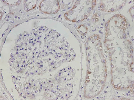 Maoa Polyclonal Antibody Reactivity Mouse