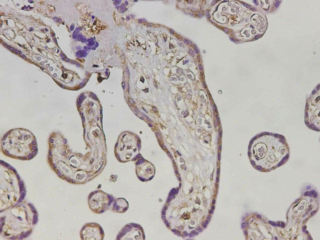 MHCG Polyclonal Antibody