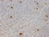 IL1A Polyclonal Antibody Reactivity Human