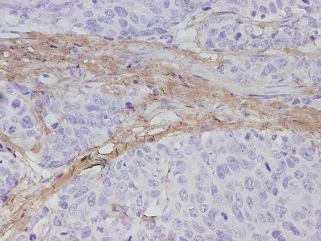 COL1A1 Polyclonal Antibody Reactivity Human