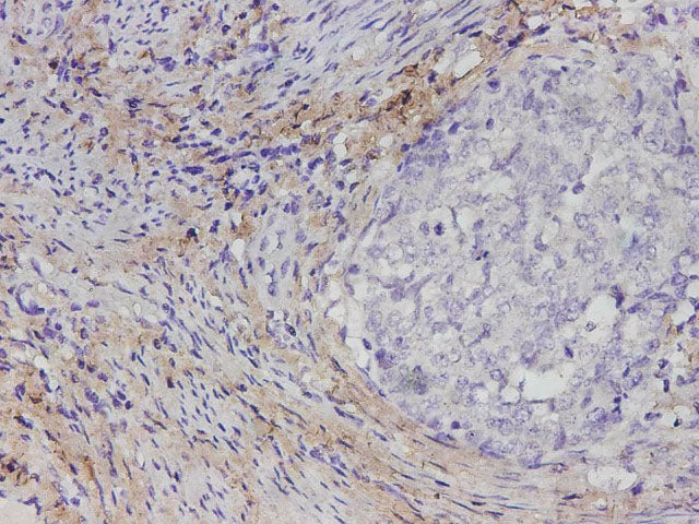 COL1A1 Polyclonal Antibody Reactivity Human