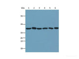 GAPDH Monoclonal Antibody Reactivity Human