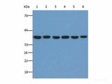 GAPDH Monoclonal Antibody Reactivity Human