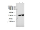 beta actin Monoclonal Antibody