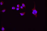 beta actin Monoclonal Antibody