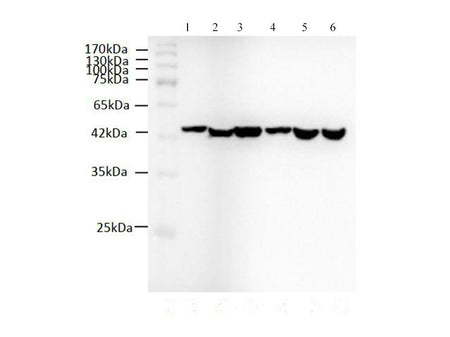 beta actin Monoclonal Antibody