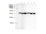 beta actin Monoclonal Antibody