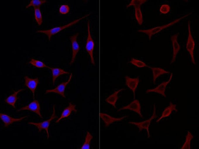 beta Tubulin Monoclonal Antibody Reactivity Human