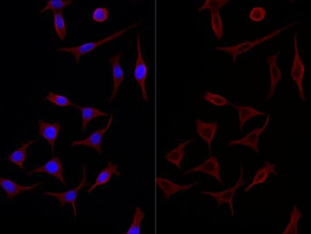 beta Tubulin Monoclonal Antibody Reactivity Human