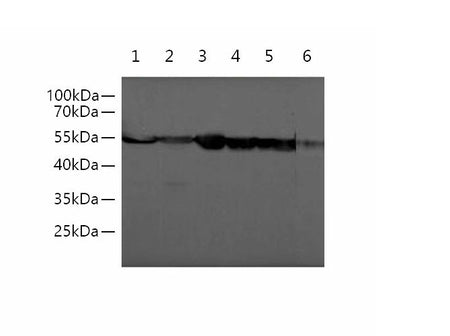beta Tubulin Monoclonal Antibody Reactivity Human