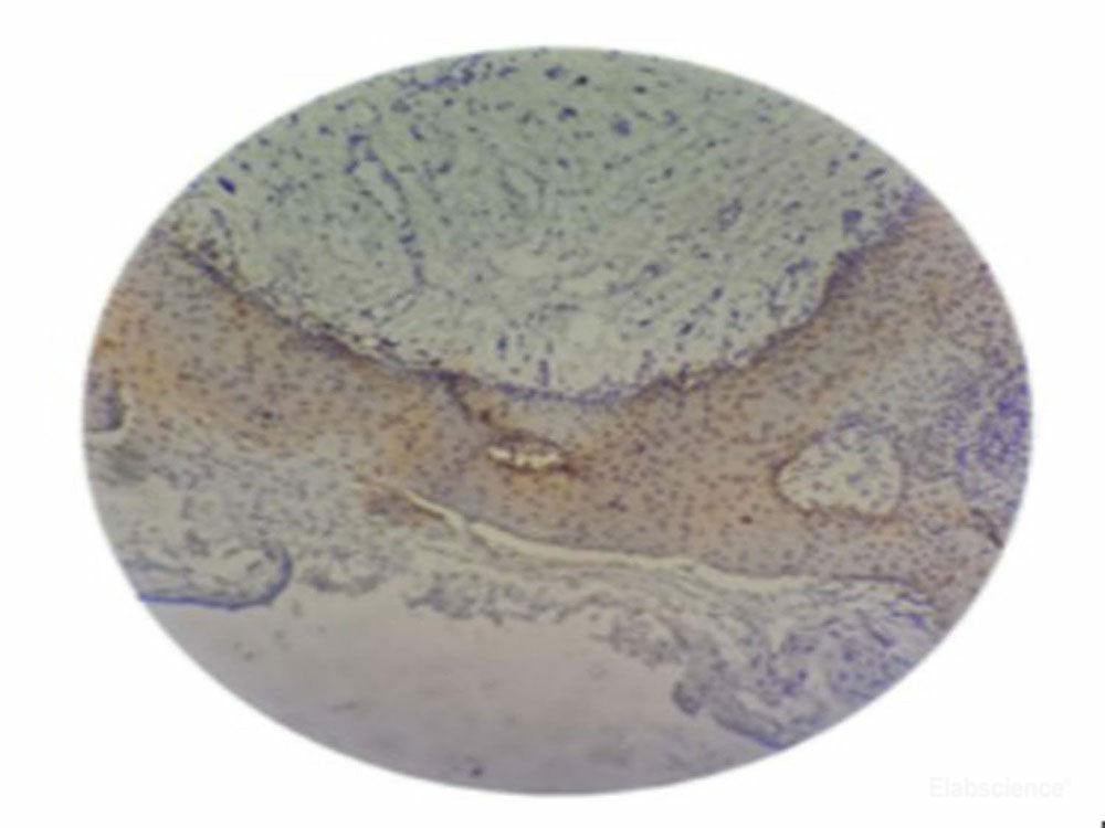 P.gingivalis Monoclonal Antibody