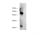 MHC class I Monoclonal Antibody(W6/32)