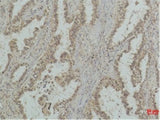 Mono-Methyl-P53 (Lys370) Monoclonal Antibody