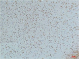 Phospho-CAMK2 beta/gamma/delta (Thr287) Monoclonal Antibody