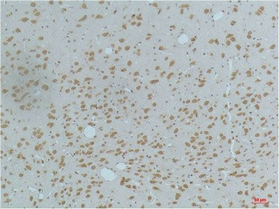 Phospho-CAMK2 beta/gamma/delta (Thr287) Monoclonal Antibody
