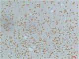 Phospho-CAMK2 beta/gamma/delta (Thr287) Monoclonal Antibody