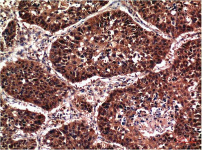 Phospho-AKT1 (Ser473) Monoclonal Antibody Reactivity Human