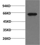 Phospho-AKT1 (Ser473) Monoclonal Antibody Reactivity Human