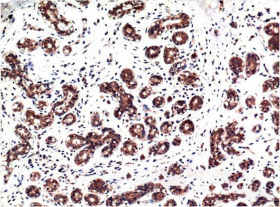 Phospho-ERK 1/2 (Tyr222/205) Monoclonal Antibody