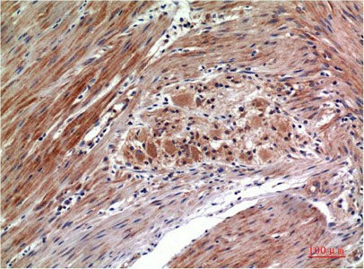 Phospho-ERK 1/2 (Tyr222/205) Monoclonal Antibody