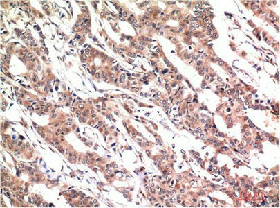 Phospho-STAT3 (Tyr705) Monoclonal Antibody