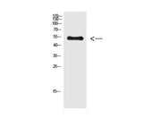 Phospho-Vimentin (Tyr38) Polyclonal Antibody