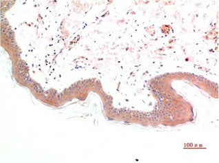 Phospho-SMAD3 (Ser425) Monoclonal Antibody