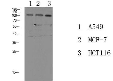 Phospho-Na+/K+-ATPase alpha1 (Tyr260) Polyclonal Antibody