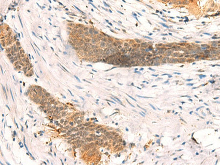 SETD1A Polyclonal Antibody Reactivity Human