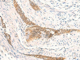 HSPA4L Polyclonal Antibody