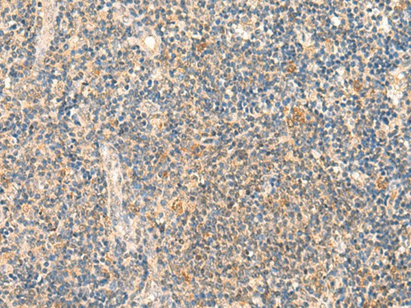 HSPA4L Polyclonal Antibody